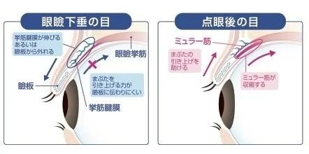 点眼後の目の変化